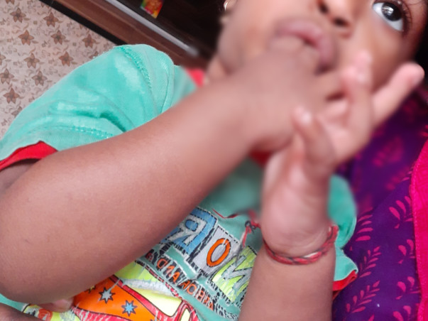 Save nabhay from Epilepsy With ADD developmental delay. Help