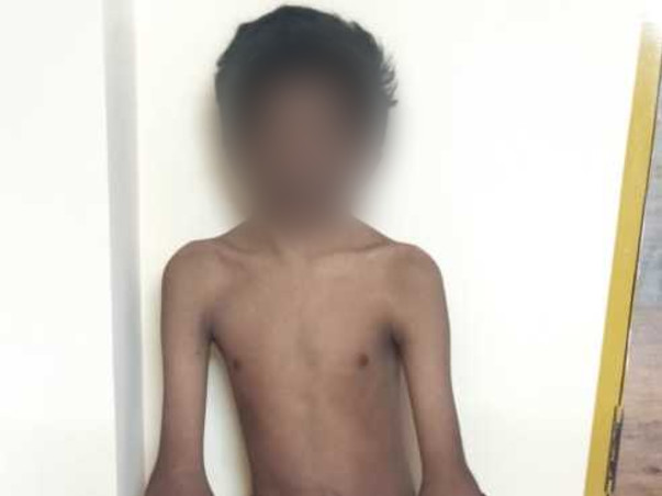 15 years old Bala Murali needs your help fight hydrosyringomyelia