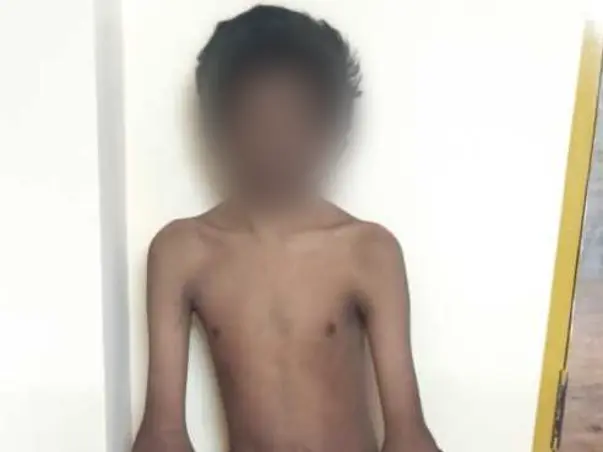 15 years old Bala Murali needs your help fight hydrosyringomyelia