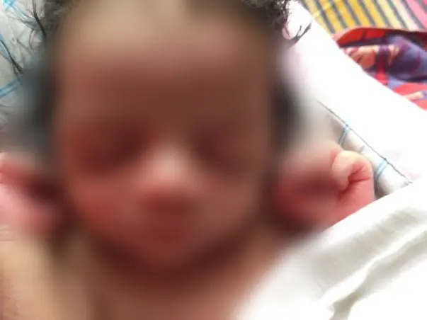 3 Months Old Mohammad Hafeez Needs Your Help To Recover From Kidney Blockage