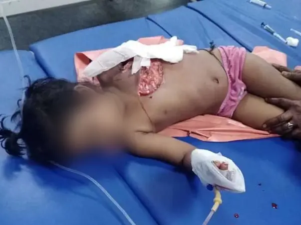 Support Nikitha Recover From Road Traffic Accident