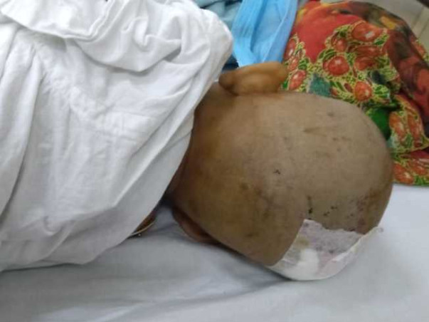 Support little Emon Recover From Brain Tumor