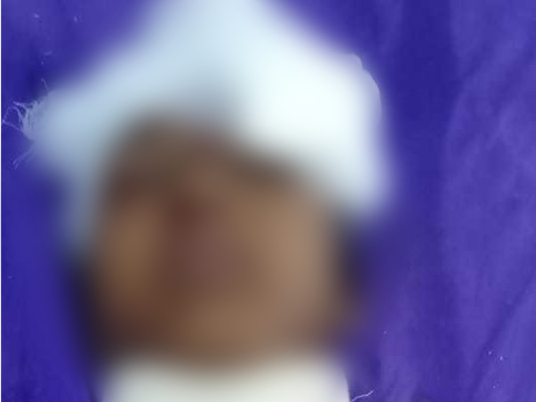 Help My Daughter Pratiskha Recover From Severe Head Injury Accident