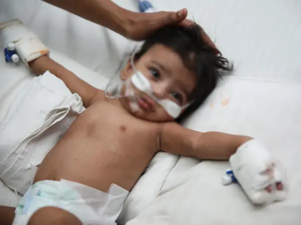Help My Son Fight Ventilation And Picu Stay For Longer Days