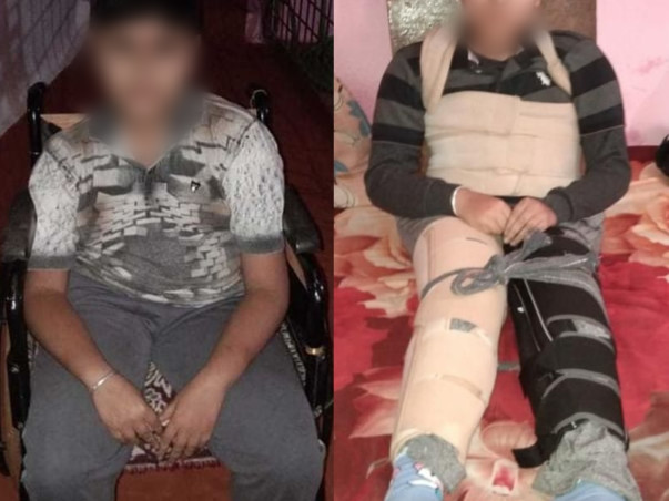 15 Years Old Vikash Meena Needs Your Help To Recover From Duchenne Muscular Dystrophy