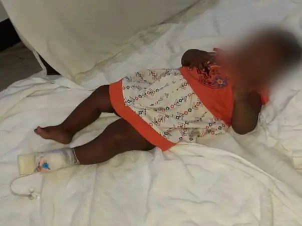 4 Months Old Ananya Needs Your Help To Recover From Ectopic Ureter With Right Duplex Kidney