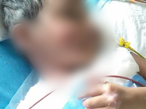 Support Syed Abrar Mohammed Recover From Electric Burn