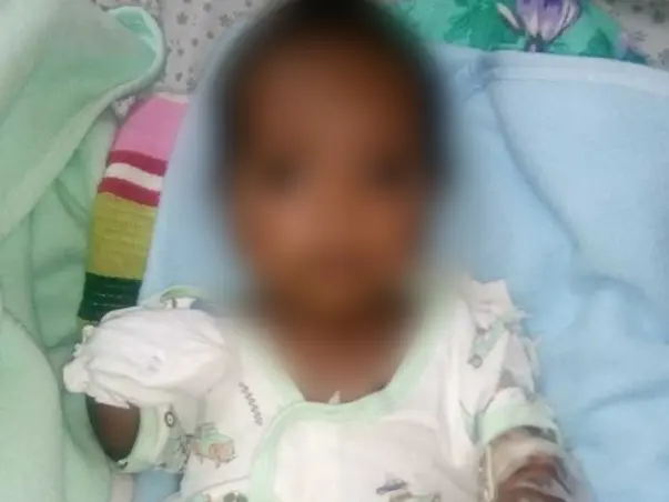 1 Month Old Baby Needs Your Urgent Support In Fighting Sepsis