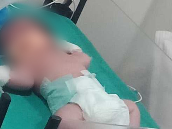 Aahil Needs Your Help To Recover From RDS And To Undergo Heart Surgery