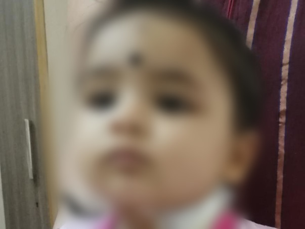 8 Months Old Baby Needs Your Help Undergo Bone Marrow Transplantation