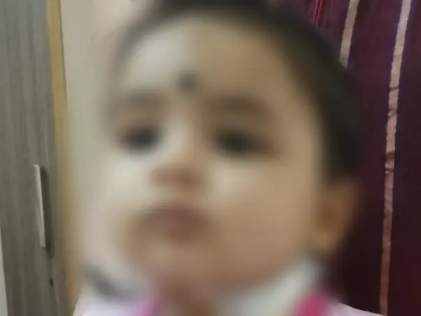 8 Months Old Baby Needs Your Help Undergo Bone Marrow Transplantation