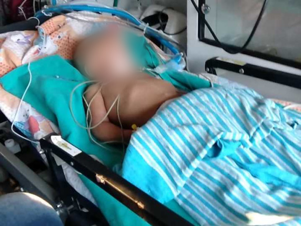 11 months old Lakshmi Chetan needs your help fight Head injury