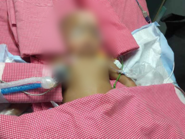 11 months old Lakshmi Chetan needs your help fight Head injury