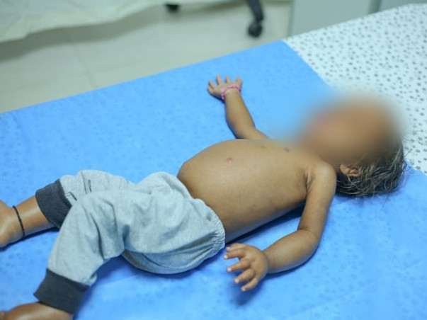 Help My Son To Undergo Liver Transplantation