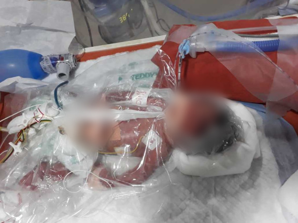 HELP MY PREMATURE BABY