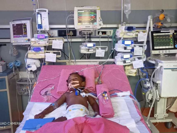 3 years old Himavardhan needs your help fight Traumatic brain injury