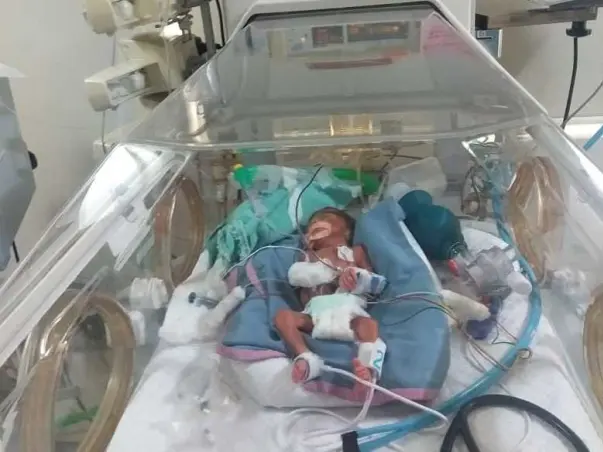 These Twin Babies Can’t Breathe Without Respiratory Support! Help!