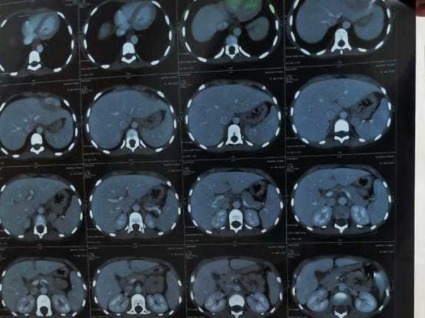 Please help bhargavi😭