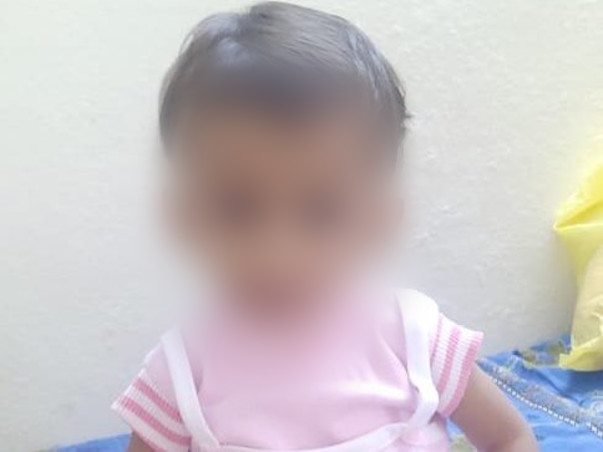 ASD Open Heart Surgery For Baby Gracy