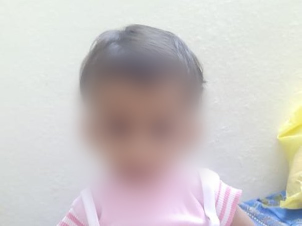 ASD Open Heart Surgery For Baby Gracy