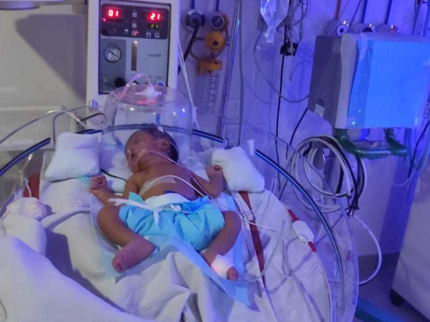 Help Srishti To Fight Lung Problem