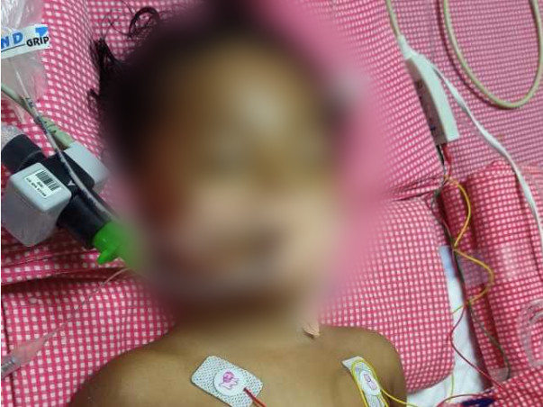 1-year-old Nandana Veda Sri Needs Your Help Fight Heart Disease