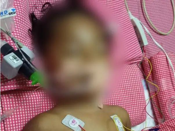 1-year-old Nandana Veda Sri Needs Your Help Fight Heart Disease