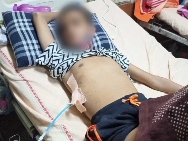 This 16 Years Old Needs Your Urgent Support in Fighting Liver Abscess