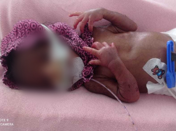 Support Baby Of Kiranmayi Recover From Premature Birth