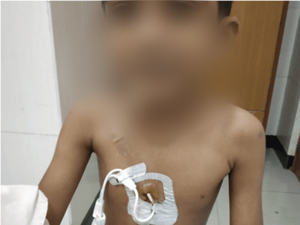 Save Aarush from Bone Marrow Failure