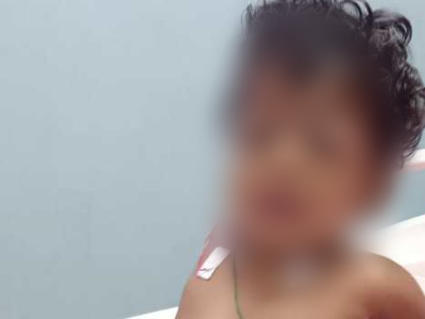 A Rare Disease Is Scarring This 1-Year-Old's Kidneys Beyond Repair