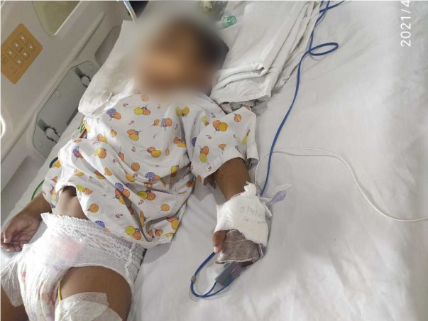 2 Years Old Mayukh Needs Your Help Fight Brain Tumour