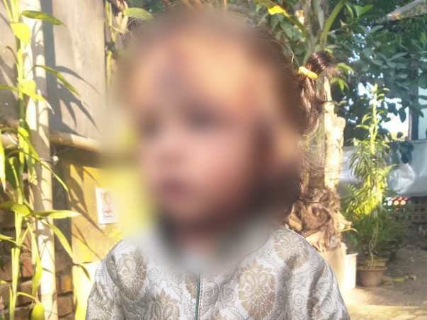 2 Years Old Mayukh Needs Your Help Fight Brain Tumour