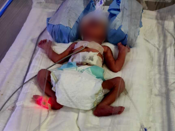 14 Days Old Baby Shivam Needs Your Help Fight Preterm Birth