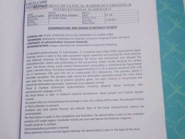 2 Years Old Mayukh Needs Your Help Fight Brain Tumour