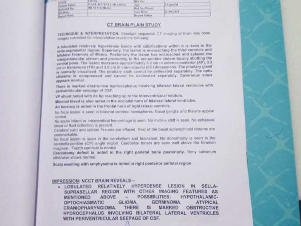 2 Years Old Mayukh Needs Your Help Fight Brain Tumour