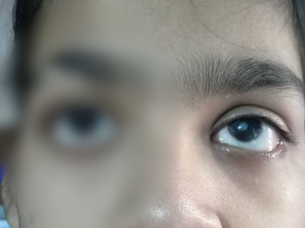 Stop Swastika From Getting Blind