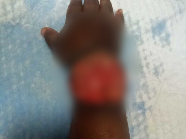 3-Years-Old Athvik Needs Your Help Fight Leukaemia Blood Cancer