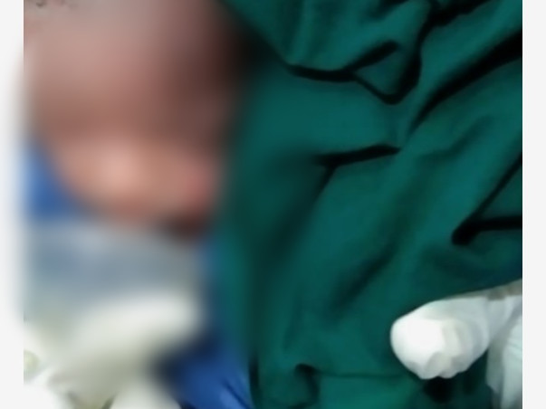 Support Baby Of Rashmi To Recover From Prematurity