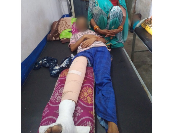 16 Years Old Sanju Kumari Needs Your Help Recover Leg Fracture