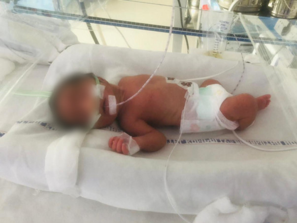 15 Days Old Babies Of Kalyani Need Your Help