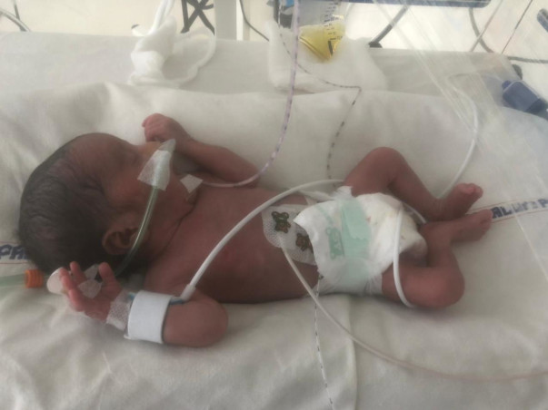 15 Days Old Babies Of Kalyani Need Your Help