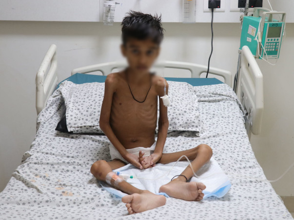 Rare Disease Has Reduced 9-Year-Old Ayaan To Just Skin And Bones!