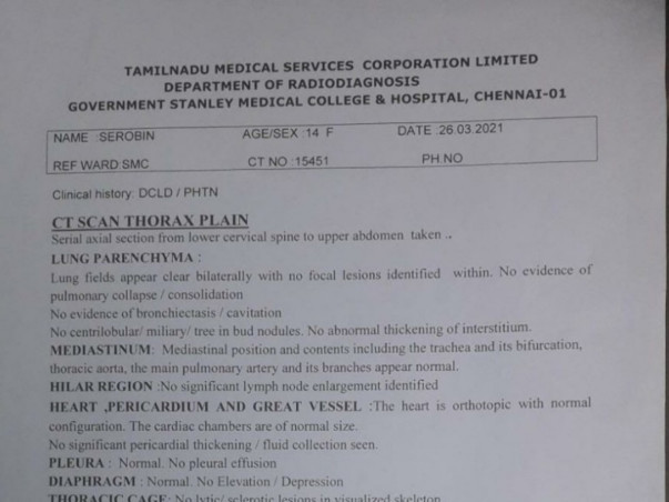 Support Serobin Recover From Liver Failure.