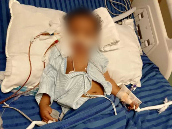 First Kidney Disease Then Covid-19, This Baby Needs Your Help To Live