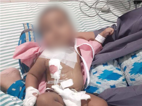 Support Dakshith Sai Recover From Severe Combined Immunodeficiency