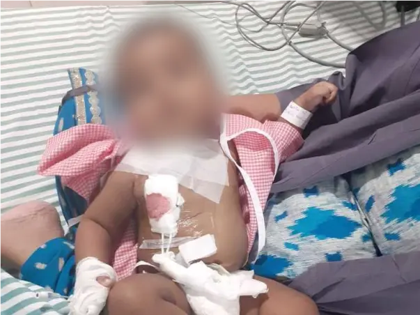 Support Dakshith Sai Recover From Severe Combined Immunodeficiency