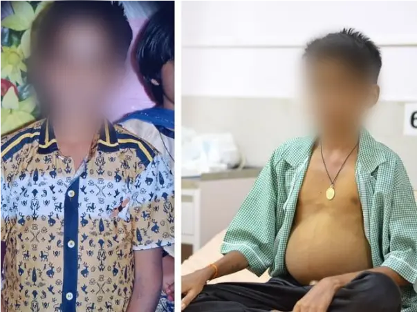 16 Years Old Darshan Gurushantappa Needs Your Help Fight Decompensated Liver Disease