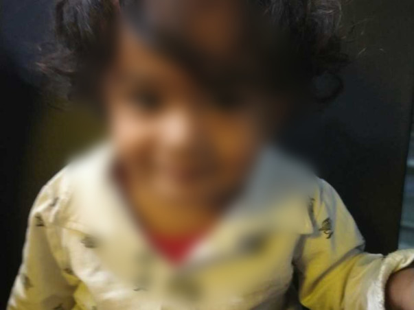 2 Years Old Aaron Needs Your Help To Recover Form Sensorineural Hearing Loss