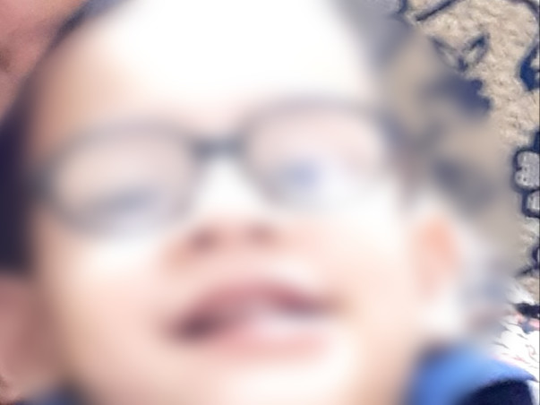 Support My Nephew To Recover From Severe Profound Prelingual Deafness